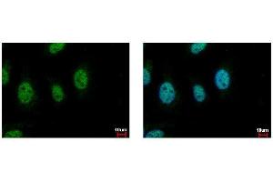 ICC/IF Image CDC45L antibody [C1C3] detects CDC45L protein at nucleus by immunofluorescent analysis. (CDC45 抗体  (Center))