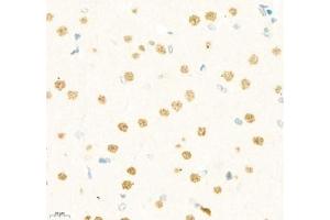 Immunohistochemistry of paraffin embedded rat brain using LDOCL (ABIN7075411) at dilution of 1:1400 (400x lens) (Retrotransposon Gag-Like Protein 6 (RTL6) 抗体)