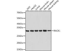 Western blot analysis of extracts of various cell lines, using R Rabbit mAb (ABIN1679360, ABIN3018118, ABIN3018119 and ABIN7101576) at 1:1000 dilution. (GNB2L1 抗体)