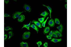 Immunofluorescence staining of HepG2 Cells with ABIN7127352 at 1:50, counter-stained with DAPI. (Recombinant ACLY 抗体)