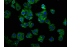 Immunofluorescence staining of HepG2 cells with ABIN7155567 at 1:66, counter-stained with DAPI. (HLA-C 抗体  (AA 200-306))