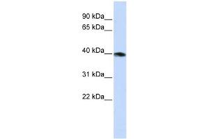 GNAZ antibody used at 1 ug/ml to detect target protein. (GNaZ 抗体)