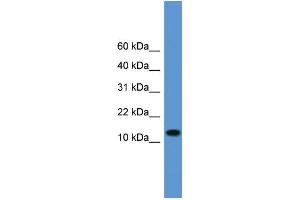 WB Suggested Anti-TAC1 Antibody Titration: 1. (TAC1 抗体  (Middle Region))