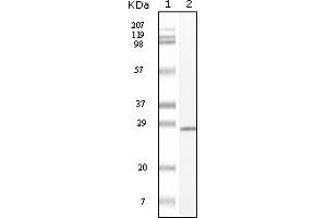 Western Blotting (WB) image for anti-Mast/stem Cell Growth Factor Receptor (KIT) (truncated) antibody (ABIN2464038) (KIT 抗体  (truncated))