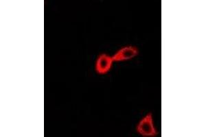 Immunofluorescent analysis of CARS staining in Hela cells. (CARS 抗体)