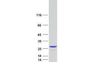 Western Blotting (WB) image for Glycolipid Transfer Protein (GLTP) protein (Myc-DYKDDDDK Tag) (ABIN2722048)