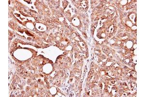 IHC-P Image Immunohistochemical analysis of paraffin-embedded NCI-N87 xenograft, using PAPSS1, antibody at 1:100 dilution. (PAPSS1 抗体)