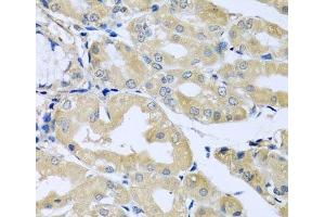 Immunohistochemistry of paraffin-embedded Human stomach using HS1BP3 Polyclonal Antibody at dilution of 1:100 (40x lens). (HS1BP3 抗体)