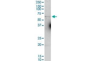 Western Blotting (WB) image for anti-Solute Carrier Family 40 (Iron-Regulated Transporter), Member 1 (SLC40A1) (AA 1-571) antibody (ABIN526239)
