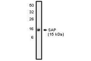 Image no. 1 for anti-SH2 Domain Containing 1A (SH2D1A) antibody (ABIN1502673) (SH2D1A 抗体)