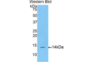 Western blot analysis of the recombinant protein. (Corin 抗体  (AA 533-634))