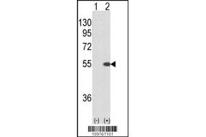 Western blot analysis of STK40 using rabbit polyclonal STK40 using 293 cell lysates (2 ug/lane) either nontransfected (Lane 1) or transiently transfected with the STK40 gene (Lane 2). (STK40 抗体  (C-Term))