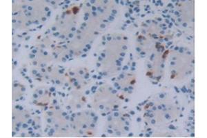 IHC-P analysis of Human Stomach Tissue, with DAB staining. (FGF18 抗体  (AA 10-199))