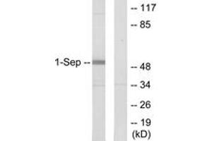 Western Blotting (WB) image for anti-Septin 1 (SEPT1) (AA 181-230) antibody (ABIN2889699) (Septin 1 抗体  (AA 181-230))