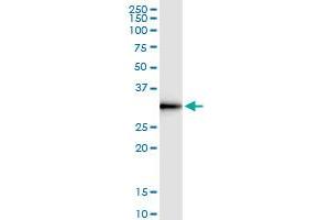 Immunoprecipitation of DNALI1 transfected lysate using anti-DNALI1 MaxPab rabbit polyclonal antibody and Protein A Magnetic Bead , and immunoblotted with DNALI1 MaxPab mouse polyclonal antibody (B01) . (DNALI1 抗体  (AA 1-258))