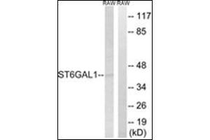 Western blot analysis of extracts from RAW264. (ST6GAL1 抗体  (Internal Region))