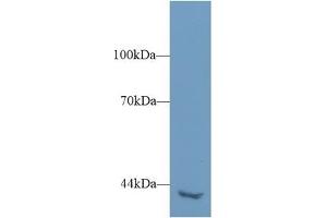 Detection of PLCh2 in Mouse Kidney lysate using Polyclonal Antibody to Phospholipase C Eta 2 (PLCh2) (PLCH2 抗体  (AA 1-257))