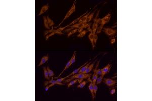 Immunofluorescence (IF) image for anti-Acyl-CoA Synthetase Long-Chain Family Member 4 (ACSL4) (AA 1-280) antibody (ABIN6136458)