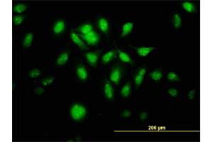 Immunofluorescence (IF) image for anti-Metastasis Associated 1 (MTA1) (AA 601-700) antibody (ABIN563943)