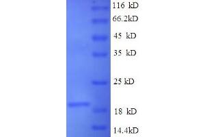 SDS-PAGE (SDS) image for Sjogren Syndrome Antigen B (SSB) (AA 1-172), (full length) protein (His-SUMO Tag) (ABIN5711479)