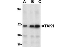 Western blot analysis of TAK1 in Rat thymus cell lysate with this product at (A) 1, (B) 2, and (C) 4 μg/ml. (MAP3K7 抗体  (N-Term))