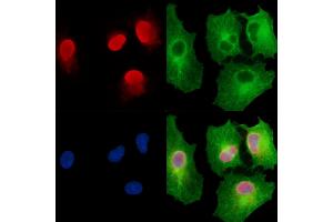 ABIN7095262 and ABIN7099319 staining  cells by IF/ICC.