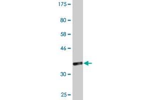 Western Blot detection against Immunogen (36. (RPL23A 抗体  (AA 59-156))