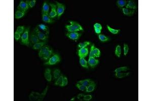 Immunofluorescence staining of HepG2 cells with ABIN7175958 at 1:100, counter-stained with DAPI. (YY1AP1 抗体  (AA 335-466))