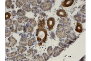 Immunoperoxidase of monoclonal antibody to MVK on formalin-fixed paraffin-embedded human salivary gland. (MVK 抗体  (AA 297-396))