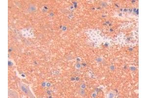 Detection of SPTAN1 in Rat Spinal cord Tissue using Polyclonal Antibody to Alpha-Fodrin (SPTAN1) (SPTAN1 抗体  (AA 2071-2269))
