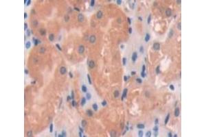 Used in DAB staining on fromalin fixed paraffin- embedded Kidney tissue (TNXB 抗体  (AA 3824-4071))