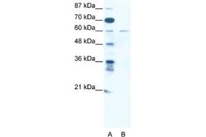 Western Blotting (WB) image for anti-Zinc Finger Protein 92 (ZNF92) antibody (ABIN2461312) (ZNF92 抗体)