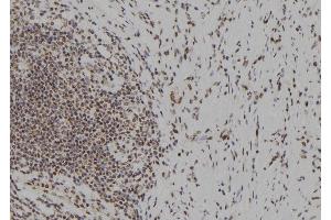 ABIN6279633 at 1/100 staining Human gastric tissue by IHC-P. (NOL9 抗体  (Internal Region))