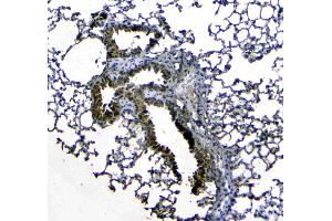 IHC analysis of Uteroglobin using anti-Uteroglobin antibody . (SCGB1A1 抗体  (AA 22-96))