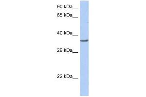 WB Suggested Anti-TFDP1 Antibody Titration:  0. (DP1 抗体  (Middle Region))