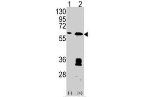 Western blot analysis of MDM2 (arrow) using MDM2 polyclonal antibody . (MDM2 抗体  (C-Term))