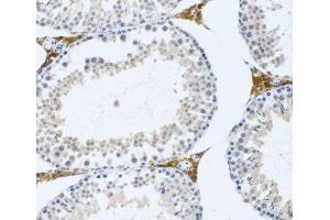 Immunohistochemistry of paraffin-embedded Mouse testis using FMOD Polyclonal Antibody at dilution of 1:100 (20x lens). (Fibromodulin 抗体)