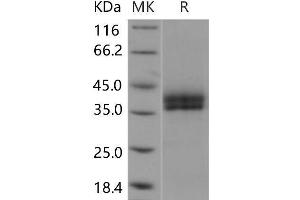 Western Blotting (WB) image for Kallikrein 11 (KLK11) protein (His tag) (ABIN7196663)