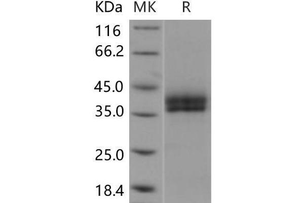 Kallikrein 11 Protein (KLK11) (His tag)