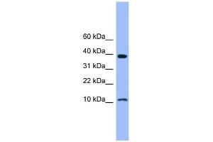 WB Suggested Anti-CSTB Antibody Titration: 0. (CSTB 抗体  (N-Term))