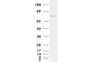 Validation with Western Blot