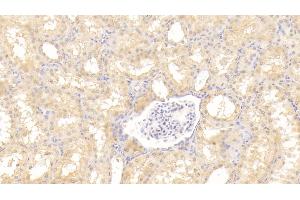 Detection of Tie1 in Human Kidney Tissue using Polyclonal Antibody to Tyrosine Kinase With Immunoglobulin Like And EGF Like Domains Protein 1 (Tie1) (TIE1 抗体  (AA 701-898))