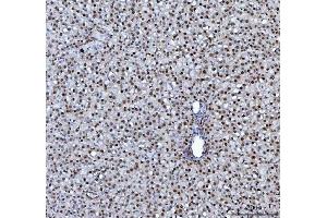 IHC analysis of hnRNP L/HNRNPL using anti-hnRNP L/HNRNPL antibody (ABIN7600130).