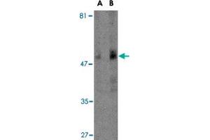 Western blot analysis of TBC1D10C in human spleen tissue lysate with TBC1D10C polyclonal antibody  at (A) 1 and (B) 2 ug/mL . (Carabin 抗体  (N-Term))