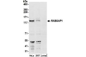anti-RAB GTPase Activating Protein 1 (RABGAP1) (AA 1-50) antibody