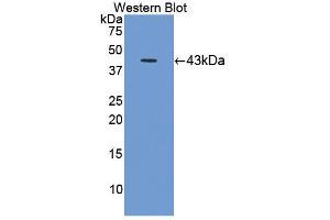 Western blot analysis of the recombinant protein. (C8B 抗体  (AA 161-503))