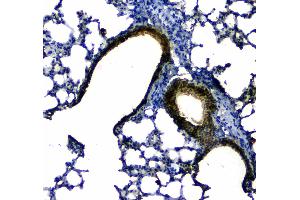 IHC analysis of Uteroglobin using anti-Uteroglobin antibody . (SCGB1A1 抗体  (AA 20-96))