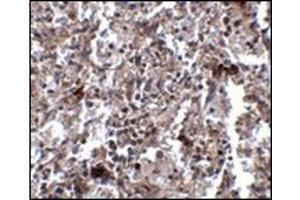 Immunohistochemistry of KCTD15 in human spleen tissue with this product at 2. (KCTD15 抗体  (C-Term))