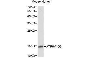 Western blot analysis of extracts of mouse kidney, using ATP6V1G3 antibody. (ATP6V1G3i 抗体)