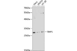 Western blot analysis of extracts of various cell lines, using TIMP1 antibody (ABIN6128284, ABIN6149176, ABIN6149177 and ABIN6218052) at 1:1000 dilution. (TIMP1 抗体  (AA 24-207))